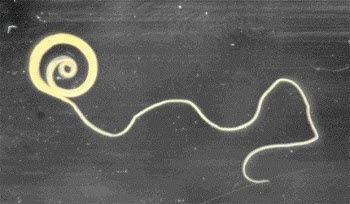 What Does Whipworm Looks Like