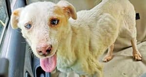 She Lost Her Sight From Worms Living In Her Eyes, But Kept Smiling Through It
